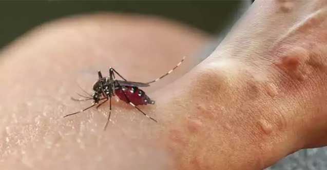 Sivrisinek ısıran hemen bunu sürsün! Her evde bulunan o bitki meğer doğal ilacıymış Prof. Dr açıkladı