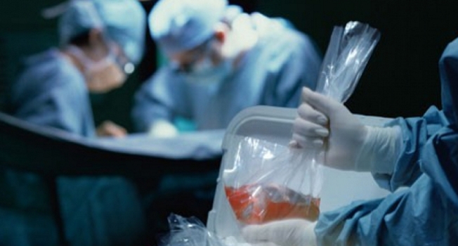Organ Nakli ve Organ Bağışı Hakkında Merak Edilenler