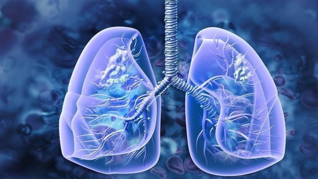 Akciğer kanserinin en yaygın belirtisi açıklandı