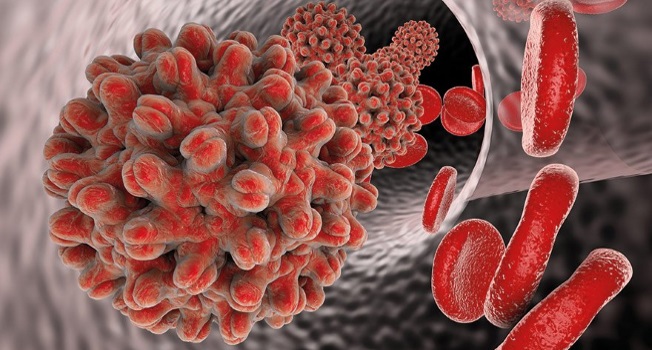 Hepatit B Nedir, Tedavisi Var Mıdır?