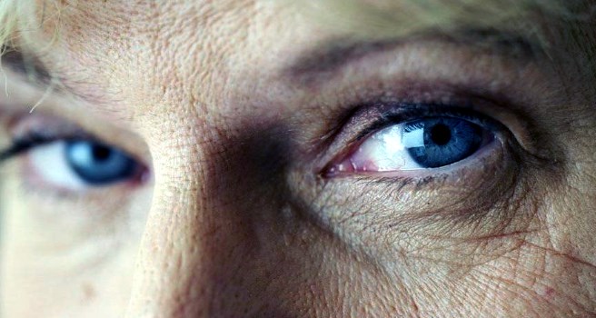 Katarakt Nedir? Belirtileri Nelerdir?