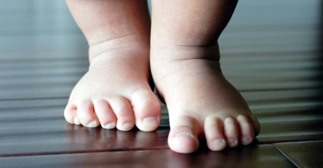 Çocuklarda dikkat edilmesi gereken ortopedik sorunlar