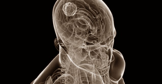 Savant sendromu nedir? Savant sendromu belirtileri nelerdir?