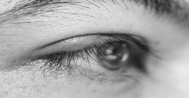 Göz şişliği nasıl geçer? Şiş gözlere ne iyi gelir?