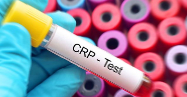 C Reaktif Protein ve CRP Değeri Nedir?  CRP Neden Yüksek Çıkar?