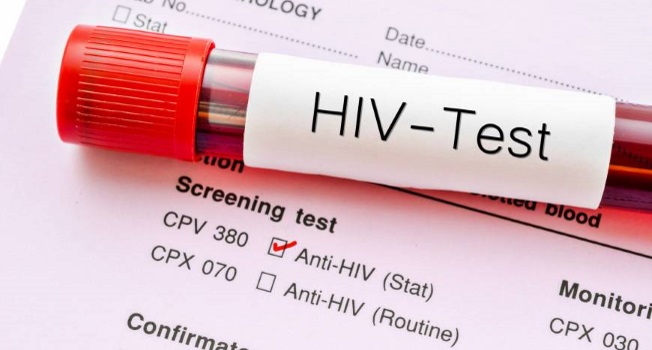 AIDS Hastalığı Nedir? Nasıl Bulaşır?