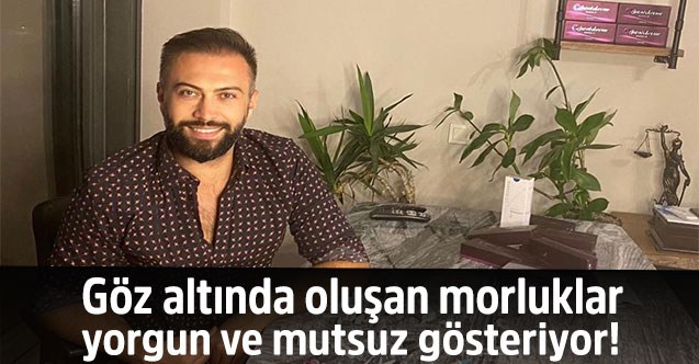 Göz altında oluşan morluklar yorgun ve mutsuz gösteriyor!