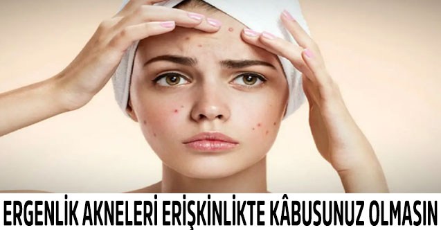 Ergenlik Akneleri Erişkinlikte Kâbusunuz Olmasın