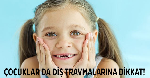 Çocuklar da Diş Travmalarına Dikkat !
