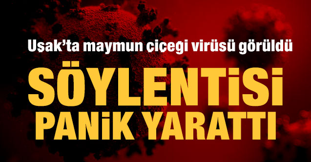 Uşak’ta “Maymun Çiçeği Virüsü Paniği”