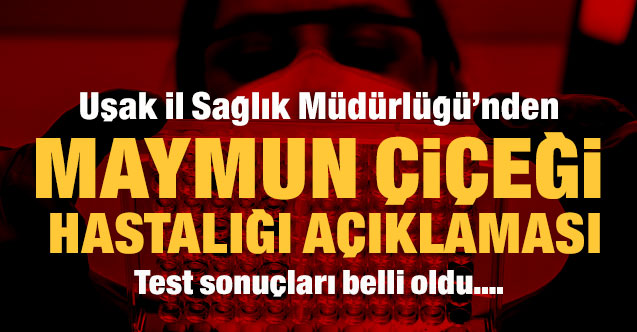 Uşak İl Sağlık Müdürlüğü’nden “Maymun Çiçeği Hastalığı” açıklaması