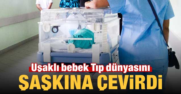 Uşaklı bebek Tıp dünyasını şaşkına çevirdi